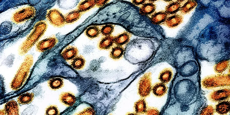 Bird flu: First US death from virus reported in Louisiana