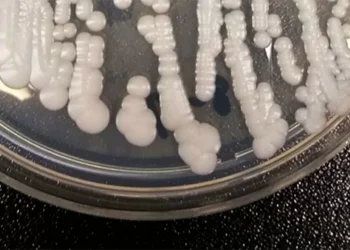Deadly, drug-resistant fungus CDC calls ‘urgent threat’ is spreading in hospitals