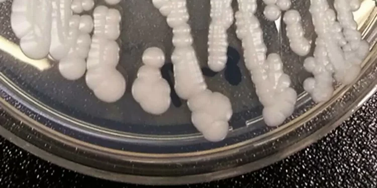 Deadly, drug-resistant fungus CDC calls ‘urgent threat’ is spreading in hospitals