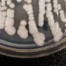 Deadly, drug-resistant fungus CDC calls ‘urgent threat’ is spreading in hospitals