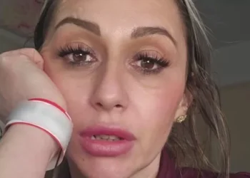 I got a red rash after going to the gym – then doctor told me what it was